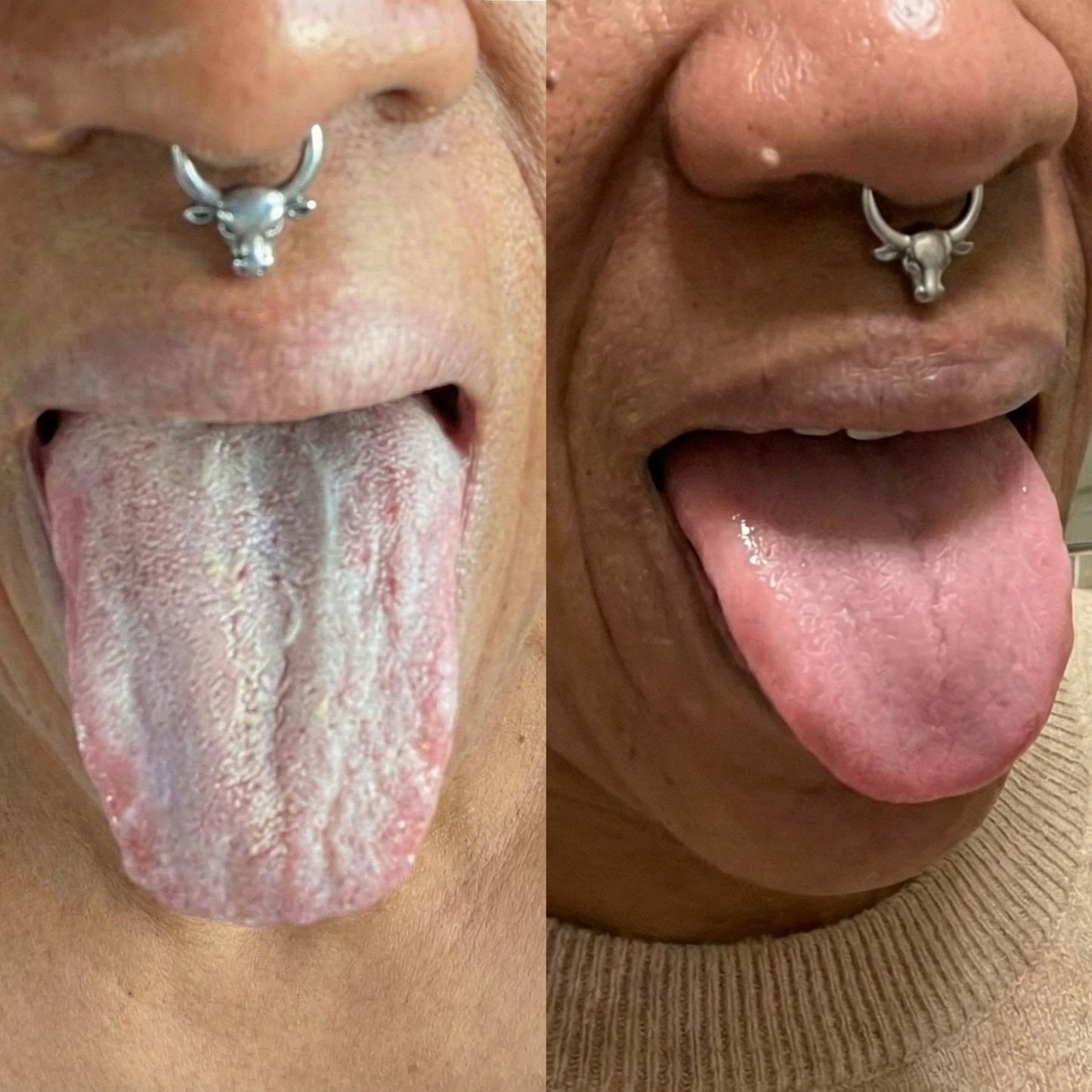Symbosis Formula - Remove Biofilm Coating & Restore Fresh Breath