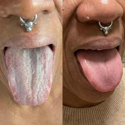 Symbosis Formula - Remove Biofilm Coating & Restore Fresh Breath