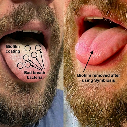 Symbosis Formula - Remove Biofilm Coating & Restore Fresh Breath